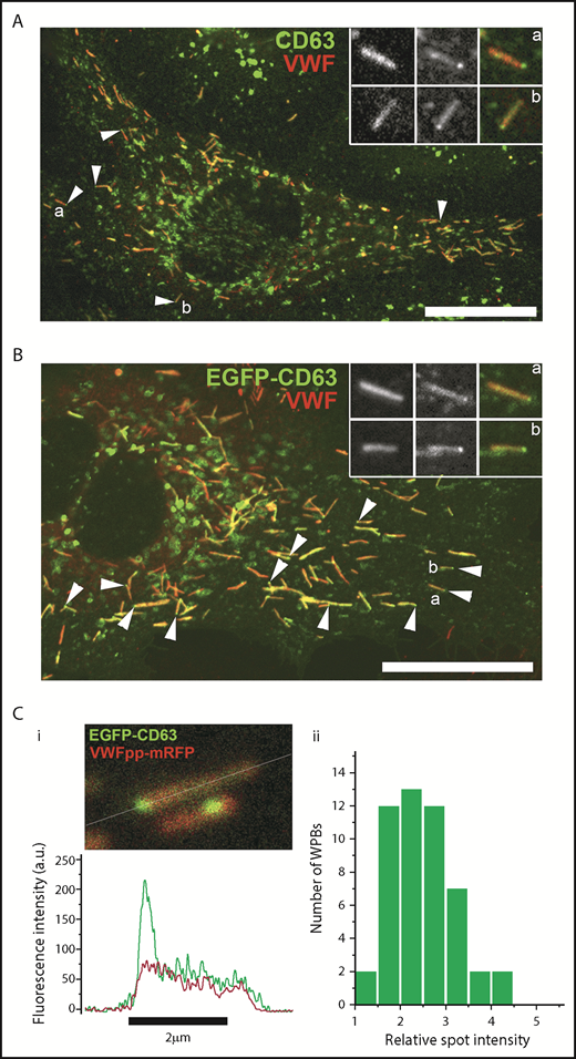 Figure 1. CD63 is enriched in microdomains on WPBs. Confocal images of a single fixed HUVEC immunolabeled with specific antibodies to CD63 (green) and VWF (red) (A) or expressing exogenous EGFP-CD63 (green) and immunolabeled for VWF (red) (B). Scale bars, 10 µm. Arrowheads indicate bright regions of CD63 (A) or EGFP-CD63 (B) closely associated with individual WPBs. Insets show, on expanded scales, the fluorescence, in grayscale, for VWF (left panels) and CD63 (middle panels) and the color merge image (right panels; VWF in red, CD63 in green) for WPBs indicated by a and b. (A-B) Images were taken at room temperature using a Leica SP2 confocal microscope (and software) equipped with a PL APO 100× 1.4NA objective. (Ci) Image from a live-cell confocal fluorescence experiment of an EGFP-CD63 (green) and VWFpp-mRFP (red) coexpressing HUVEC showing 2 WPBs containing discrete bright microdomains of EGFP-CD63 fluorescence. Intensity plots through the long axis of the upper WPB (white line) are shown in the line graph below (green: CD63, red VWFpp). (Cii) Histogram of the fold increase in mean EGFP fluorescence intensity in microdomains compared with nonmicrodomain regions (bulk WPB membrane) for 50 WPBs. Mean microdomain EGFP intensity was 2.5- ± 0.7-fold (n = 49 WPBs; range, 1.4-4.1) that in the bulk membrane of the corresponding WPB. (C) Images were taken at 37°C using a Leica SP5 with an HCX PL APO CS 100× 1.46NA oil objective, pinhole (airy) 1.5, zoom 30 to 35.5, scan speed 1400 Hz in xyt acquisition mode.