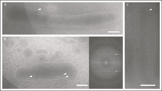 Figure 2. Electron cryomicroscopy of frozen-hydrated HUVECs showing WPBs in cytoplasm. (A-C) Two-dimensional images of WPBs show internal density for VWF tubules. ILVs are indicated by arrowheads. Fourier transform of WPB interior in panel B shows helical layer lines for VWF (arrows). Scale bars, 200 nm.