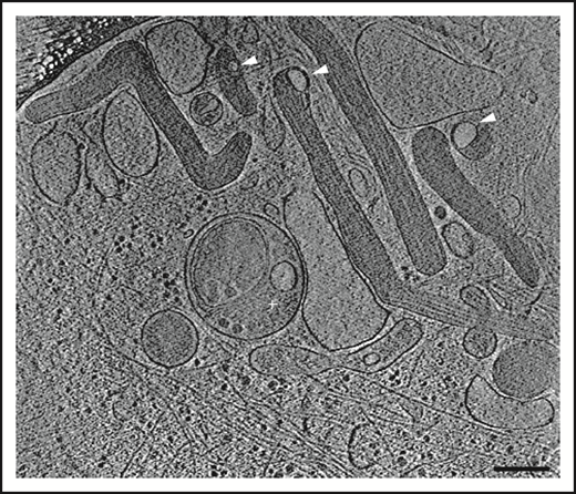 Figure 3. Section of an electron cryotomogram of a frozen-hydrated endothelial cell showing region with WPBs. ILVs within WPBs are indicated by arrowheads. Scale bar, 200 nm.