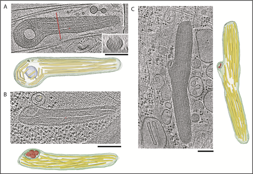 Figure. 4. Tomogram sections of WPBs containing ILVs along with structural models. (A-C) Tomogram section with structural model consisting of WPB limiting model (green), ILV membrane (blue-green), VWF tubules (yellow), and ILV internal content (red). (A) Inset shows tomogram cross-section at the location of the red line. (B) WPB from an HHMEC with an ILV in the left side of the granule. The ILV contains internal content similar to cytoplasmic granules, as shown in supplemental Figure 4. (C) WPB in a HUVEC with a kink in the middle where tubules have disrupted paracrystalline order. The ILV contains densities similar in size to cytosolic densities visible throughout the tomogram section. Scale bars, 200 nm.