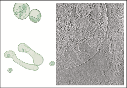 Figure 5. Tomogram section showing WPBs and MVBs. Tomogram section (right panel) shows WPBs and MVBs containing ILVs, as indicated in the structural model (left panel). Scale bar, 200 nm.