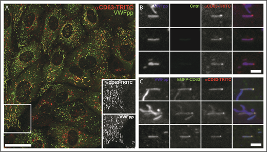 Figure 6. CD63 in WPB ILVs is of endosomal origin. (A) Confocal fluorescence image of HUVECs incubated live in the presence of an extracellular TRITC-conjugated mouse anti-CD63 antibody (red; 1:55 dilution; 24 hours). The cells were fixed and immunolabeled with a specific antibody to VWFpp (green). Scale bar, 20 µm. The region in the white box is shown as grayscale insets to illustrate the accumulation of extracellularly applied TRITC–anti-CD63 in WPBs. Examples of the accumulation of extracellularly applied TRITC-anti-CD63 in microdomains in WPBs in control (B; mock transfected) or EGFP-CD63–transfected (C) HUVECs incubated live with the TRITC–anti-CD63 antibody (red) and subsequently immunolabeled for VWFpp (blue) and EGFP-CD63 (anti-GFP antibody, green). TRITC–anti-CD63 can be seen in bright microdomains on WPBs that colocalized with EGFP-CD63 microdomains. Scale bars, 2 µm.