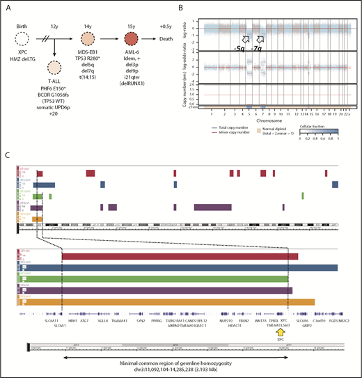 Figure 1. Germline genetics and clonal evolution in patients with XP-C with MDS and leukemia. (A) Bone marrow progression in patient #5 (XP924VI) showing clonal evolution. Chromosomal abnormalities and somatic point mutations are shown. (B) Copy number and allele heterozygosity analysis of the bone marrow MDS-EB1 sample showing deletion 5q and 7q (arrows) in patient #5. WES data were analyzed using the FACETS tool; total copy number log-ratio (logR; upper); allele-specific log-odds-ratio data (logOR; middle); corresponding integer (total, minor) copy number calls (bottom). The estimated cellular fraction (cf) profile is plotted at the bottom. (C) Minimal common region of germinal homozygosity in 3p25 including the XPC gene (yellow arrow), as shown by the analysis of single nucleotide polymorphism array data in the 5 patients with available fibroblast cell DNA (Affymetrix array) and confirmed using WES data (Illumina). Data are shown using the Genome Wide SNP6 Array and the Chromosome Analysis Suite. Loss of heterozygosity segments on chromosome 3 (top); minimal region of homozygosity as mapped by patient XP10VI and XP309VI, on the left and right sides (genomic position on chr3: 11 092 104 and 14 285 238, using hg19 reference, NM_00628.4), respectively (bottom).