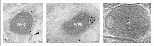Weibel-Palade bodies and alpha granule. (A-B) Immunogold localization of CD63 on WPBs. Arrowhead indicates a transport vesicle in close position to the WPB (WPB). (C) Tomographic slice of vitrified platelet α-granule (α). Scale bars, 40 nm.