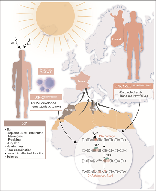 Rare patient populations in France and Finland reveal that gene mutations resulting in defective NER predispose to hematopoietic malignancies. Patients with XP are extremely sensitive to UV radiation from the sun and develop skin cancers and other problems as outlined. Homozygous founder mutations in genes encoding NER components lead to genetic susceptibility to hematopoietic malignancies: XP-CdelTG in descendants of North African immigrants to France and ERCC6L21457delT within the Finnish population. XP-C is the first NER protein to bind the damaged DNA, beginning a cascade of reactions resulting in an excised DNA fragment, repair of the gap, and resolution of the initial lesion, as shown in the inset. ERCC6L2 is part of transcription-coupled repair. When these critical NER components are absent (as is the case for homozygous XP-CdelTG mutations) or truncated prematurely (as is the case for homozygous ERCC6L21457delT mutations), TP53 mutations occur and drive leukemia development. AML, acute myeloid leukemia; MDS, myelodysplastic syndrome; T-cell ALL, T-cell acute lymphoblastic leukemia. Professional illustration by Luk Cox, Somersault18:24.
