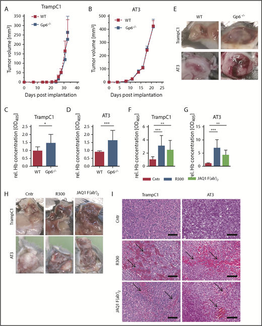 Figure 1. Increased bleeding in TrampC1 and AT-3 primary tumors in GPVI-deficient animals and upon GPVI blockade. TrampC1 prostate (A) and AT-3 breast cancer (B) tumors were grown in GPVI-deficient (Gp6−/−) mice. Tumor growth was measured every second day for 31 (A) or 21 (B) days postimplantation (n = 8; mean ± SEM). (C-E) The relative hemoglobin (rel. Hb) content was measured 31 or 21 days postimplantation (n = 8; mean ± SD). Effect of platelet depletion (R300 antibody against GPIbα) and GPVI blockade (JAQ1 F(ab′)2) on TrampC1 (F) and AT-3 (G) primary tumors grown in C57BL/6 animals 18 hours after antibody treatment. Relative quantification of the hemoglobin content in TrampC1 (F; n = 15) and AT-3 tumors (G; n = 10) (mean ± SD). Representative pictures (H) and hematoxylin and eosin staining (I) of the tumors. Arrows indicate accumulation of red blood cells in the tumor tissues. Scale bars, 100 µm. ***P < .001, **P < .01, and *P < .05; Kruskal-Wallis with Dunn’s multiple comparisons test. WT, wild-type.
