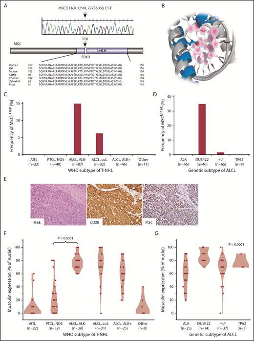 Figure 1. Recurrent MSCE116K mutations in ALK−ALCLs with DUSP22 rearrangements. (A) Sanger sequencing validated MSCE116K (chr8:72756068C>T) as shown (representative tracing from 3 independent samples). The mutation affected the conserved ERXR motif within the DNA binding domain of the bHLH transcription factor musculin. (B) Structural prediction of interaction between MSC (blue) and target DNA placed the mutated E116K residue (red) within the major groove. The model is superimposed on the TAL1:E2A experimental structure (gray) for comparison. (C) Data on 238 T-NHLs from exome sequencing and additional targeted resequencing of MSC identified MSCE116K exclusively in ALK− ALCLs, including systemic (ALCL, ALK−; frequency, 14.9%) and primary cutaneous (ALCL, cut.; 6.3%) types (P < .0001, cutaneous and systemic ALK− ALCLs vs all other subtypes, Fisher’s exact test,). Additional case details are given in supplemental Table 3. (D) Genetic subtyping of 160 ALCLs into ALK, DUSP22, TP63, and triple-negative (−/−/−) subtypes showed that MSCE116K was nearly exclusively associated with DUSP22 rearrangements (frequency, 35%; P < .0001, DUSP22 subtype vs all other subtypes, Fisher’s exact test). (E) ALK− ALCL with DUSP22 rearrangement and MSCE116K. Hematoxylin and eosin (H&E) stain shows sheets of large tumor cells (original magnification × 400). By immunohistochemistry, the tumor cells show strong and uniform staining for CD30 and musculin (nuclear staining pattern). See also supplemental Figure 4A. (F) Among WHO subtypes of T-NHL (N = 147), musculin protein expression was highest in systemic and cutaneous ALK− ALCLs. Data reflect the percentage of tumor cell nuclei positive for musculin by immunohistochemistry. Additional case details are given in supplemental Table 4. (G) Musculin expression was highest in ALCLs with DUSP22 rearrangements. The P value refers to differences among the 4 genetic subtypes.
