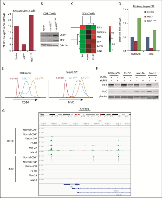 Figure 5. MSCE116K augments expression of the CD30–IRF4–MYC axis in normal and neoplastic T cells. (A) Expression of the TNFRSF8 gene encoding CD30 is increased in normal T cells transduced with MSCE116K. Data are from RNAseq. Representative results from 2 independent experiments. (B) CD30 protein expression is increased in normal T cells transduced with MSCE116K. (C) Heat map showing downregulation of E2F2 and upregulation of genes involved in the CD30–IRF4–MYC axis in response to MSCE116K in normal CD4+ T cells. Data are from RNAseq. Representative results from 2 independent experiments. (D) Expression levels of TNFRSF8 and MYC are increased in Karpas 299 cells transduced with MSCE116K. These RNAseq data are from the same experiment shown in Figure 4B. Representative results from 2 independent experiments. (E) Overexpression of E2F2 in Karpas 299 cells decreases expression of CD30 and MYC. Data are from flow cytometry. Representative results from 3 independent experiments. (F) IRF4 knockdown in ALCL cell lines decreases MSC expression. (G) IRF4 ChIP-seq demonstrates binding of IRF4 to the MSC locus 2.3 kb downstream and 2.4 kb and 7.2 kb upstream of the transcriptional start site in ALCL cell lines. MSC-AS1 is a noncoding RNA gene that was minimally expressed at the RNA level and showed no significant differential expression after IRF4 knockdown. RPKM, reads per kilobase of transcript per million mapped reads.