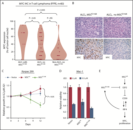 Figure 6. Potential therapeutic targeting of ALCLs with MSCE116K. (A) Immunohistochemistry for MYC in 83 T-NHLs with and without MSCE116K, as indicated. Additional case details are given in supplemental Table 8. (B) Representative MYC expression in ALCLs with and without MSCE116K. (C) Karpas 299 cells expressing MSCE116K are more sensitive to JQ1 than are cells expressing MSCwt. Data represent relative fractions of GFP− cells in 0.2 μM JQ1 compared with vehicle for each of the constructs in competition with Karpas 299 cells overexpressing GFP. Summary of 3 independent experiments. (D) Treatment of Mac-1 cells stably expressing MSCwt or MSCE116K with JQ1 revealed increased sensitivity of MSCE116K to JQ1 compared with MSCwt (P = .004). (E) Model of interactions among MSC, E2F2, CD30, IRF4, and MYC in ALCL cells with MSCwt or MSCE116K. Briefly, MSCwt transcriptionally regulates E2F2 (Figure 4), and the resultant E2F2 protein represses expression of TNFRSF8 encoding CD30 (Figure 5). MSCE116K sequesters bHLH proteins but fails to bind to DNA, preventing heterodimer binding to canonical musculin and E2A target sequences (Figure 2) and inhibiting E2F2-mediated repression of CD30 (Figure 5). CD30 and IRF4 augment each other’s expression in a positive-feedback loop that leads to increased MYC expression and proliferation, as described previously.39 In addition, IRF4 transcriptionally regulates MSC to increase expression of MSCE116K, further augmenting expression of the CD30–IRF4–MYC axis (Figure 5). Although transcriptional regulation of MSC by IRF4 may also increase expression of MSCwt, this arrow is not indicated in the model because IRF4-MSCwt is not implicated in the same positive-feedback mechanism as IRF4-MSCE116K, MSCwt function is inhibited by the presence of dominant-negative MSCE116K, and MSCwt protein is less stable than MSCE116K and is present at lower levels. NS, not significant.