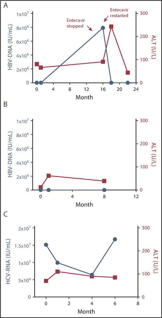 Figure 1. Trends in HBV DNA/HCV RNA and ALT after CAR–T-cell infusion. HBV/HCV DNA and ALT levels are shown. The x-axis represents time from axi-cel infusion (months). Actual DNA/ALT measurements are represented by dots. (A) Patient 1. (B) Patient 2. (C) Patient 3.