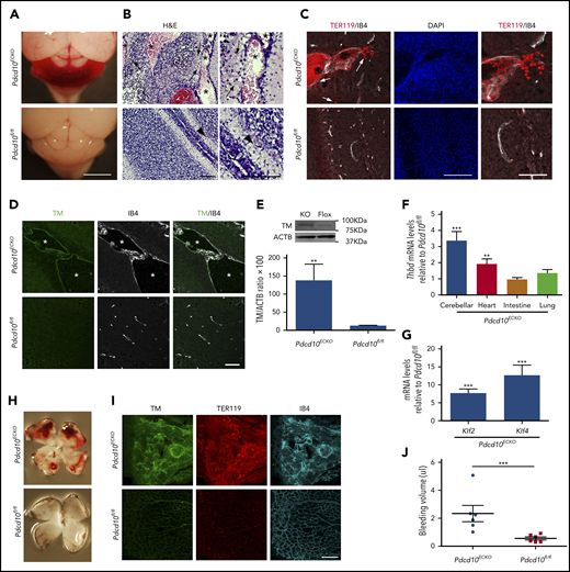 Figure 5. Loss of Pdcd10 increased expression of brain endothelial TM. (A) Pdcd10ECKO hindbrains show prominent hemorrhagic lesions. Scale bar, 2 mm. (B) Hematoxylin and eosin staining of cerebellar sections from Pdcd10ECKO mice and Pdcd10fl/fl littermate controls. Arrows indicate bleeding into the brain parenchyma, and arrowheads indicate normal cerebral vasculature. Asterisks denote the vascular lumen of CCM lesions. Higher-magnification images are shown (right panels). Scale bars, 100 μm (n = 4 mice in each group). (C) Immunofluorescence staining of blood cells using TER119 (red) and labeling of the microvasculature, using isolectin B4 (white), of cerebellar sections from Pdcd10ECKO or Pdcd10fl/fl mice at P9; DAPI staining (blue) was used to reveal nuclei (left and middle panels). Arrows indicate bleeding into the brain parenchyma. Scale bar, 100 μm. Higher-magnification images are shown (right panels; scale bar, 50 μm). (n = 3 mice in each group). (D) Immunofluorescence staining of TM (green) or isolectin B4 (IB4; white) of cerebellar sections from Pdcd10ECKO and Pdcd10fl/fl mice. Asterisks denote the vascular lumen of CCM lesions. Scale bar, 50 μm (n = 4 mice in each group). (E) Quantification of TM in cerebellar tissue in Pdcd10ECKO and control Pdcd10fl/fl littermates, as assessed by western blot analysis (SEM, n = 4 or 7 mice in each group). (F) Analysis of Thbd mRNA levels by RT-qPCR in cerebellar, heart, intestine, and lung tissue from Pdcd10ECKO mice compared with control Pdcd10fl/fl littermates (SEM, n = 6 or 8 mice in each group). (G) Analysis of Klf2 and Klf4 mRNA levels by RT-qPCR in cerebellar tissue in Pdcd10ECKO mice compared with control Pdcd10fl/fl littermates (SEM, n = 7 mice in each group). (H) Whole-mount P9 retinas show hemorrhage in Pdcd10ECKO mice but not in littermate control Pdcd10fl/fl mice. (I) Maximum-intensity projection of whole-mount P9 retinal vasculature at the angiogenic growth front stained for TM (green) and for red blood cells using TER119 antibodies (red); retinal vasculature was labelled with isolectin B4 (IB4; turquoise) (n = 4). (J) Measurement of hemoglobin content of extravasated erythrocytes from retinal vasculature at P10 in Pdcd10ECKO mice and control Pdcd10fl/fl littermates. **P < .01, ***P < .001, Student t test and 1-way ANOVA, followed by the Tukey post hoc test.