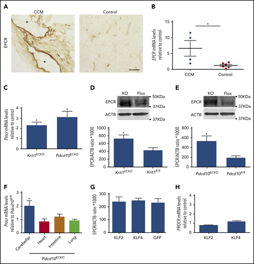 Figure 6. Increased EPCR in CCMs. (A) Immunohistochemistry of EPCR (brown precipitate) of human CCMs and brain tissue from a healthy subject as control. Asterisks denote vascular lumen of CCM lesions. Scale bar, 100 μm (n = 3). (B) Analysis of PROCR (EPCR) mRNA levels by RT-qPCR in human CCM lesions or control brain tissue in (A) (SEM, n = 4 CCM tissue, n = 1 lesion-free brain tissue from CCM patient, n = 2 healthy subject brain tissue, and n = 2 postmortem specimens as control). (C) RT-qPCR analysis of Procr (Epcr) mRNA in Krit1ECKO or Pdcd10ECKO BMECs compared with Krit1fl/fl or Pdcd10fl/fl BMECs (control), respectively (SEM, n = 3). (D) Quantification of EPCR protein in 9-day Krit1ECKO (KO) BMECs compared with Krit1fl/fl (Flox) BMECs (SEM, n = 3). (E) Quantification of EPCR protein in 20-day Pdcd10ECKO (KO) BMECs compared with Pdcd10fl/fl (Flox) BMECs (SEM, n = 3). (F) Analysis of Epcr mRNA levels by RT-qPCR in cerebellar, heart, intestine, and lung tissue in Pdcd10ECKO mice and control Pdcd10fl/fl littermates (SEM, n = 4 or 7 mice in each group). (G) Analysis of EPCR protein levels in human umbilical vein endothelial cells transduced with lentivirus encoding KLF2 or KLF4, as assessed by western blot analysis; lentivirus encoding GFP was used as control (SEM, n = 3). (H) Analysis of EPCR mRNA levels by RT-qPCR in human umbilical vein endothelial cells transduced with lentivirus encoding KLF2 or KLF4 compared with lentivirus encoding GFP as control (SEM, n = 3 or 4). *P < .05, Student t test and 1-way ANOVA, followed by the Tukey post hoc test.