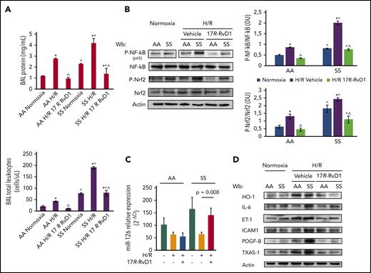 Figure 5. 17R-RvD1 prevents H/R activation of acute inflammatory response pathways and reduces SCD vascular vulnerability through multimodal action on NF-κB activation. (A) BAL protein content (upper panel) and leukocyte content (lower panel) from AA and SS mice under normoxia and treated with vehicle or 17R-RvD1 (100 ng) and exposed to H/R: hypoxia (8% oxygen; 10 hours), followed by reoxygenation (21% oxygen; 3 hours) (upper panel). All data are mean ± SD (n = 6). (B) Immunoblot analysis, using specific antibodies against phosphorylated (P-)NF-κB, NF-κB, P-Nrf2, and Nrf2, in lung from AA and SS mice treated as in (A) (left panel). Vertical line(s) in NF-κB, P-p65 gel have been inserted to indicate a repositioned gel lane. One representative gel from 6 gels with similar results is presented. Densitometric analysis of immunoblots (right panels). Data are mean ± SD (n = 6 in each group). (C) Expression of miR-126 (mmu–miR-126-5p), as determined using quantitative polymerase chain reaction, in the lungs of AA and SS mice undergoing H/R and 17R-RvD1 treatment. Results are mean ± SD from 3 to 6 mice per group. (D) Immunoblot analysis, using specific antibodies against HO-1, IL-6, ET-1, ICAM-1, PDGF-B, and TXAS-1, of lung from AA and SS mice treated as in (B). One representative gel from 6 gels with similar results is shown. Densitometric analysis immunoblots are shown in supplemental Figure 2A. *P < .05 vs normoxia, °P < .05 vs healthy mice (AA), ^P < .05 vs vehicle.