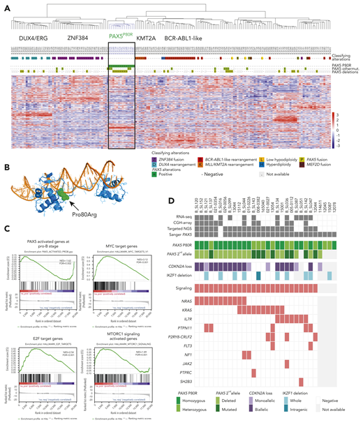 Figure 1. PAX5P80R mutation defines a subtype of BCP-ALL with distinct transcriptional signature and genomic alterations. (A) Unsupervised hierarchical clustering of RNA-seq gene-expression data of 170 BCP-ALL cases. The color coding of genetic annotations is indicated at the bottom of panel A. (B) Structural modeling of PAX5 P80R mutation based on the crystal structure of the paired box DNA binding domain of PAX5 (PDB 1K7821). The Pro80 mutated to Arg (indicated in green) is located in the linker nearby the N-terminal helix. The PD is depicted in blue; the DNA helix is depicted in orange. (C) Gene Set Enrichment Analyses of genes expressed in PAX5P80R cases as compared with other cases. Gene Set Enrichment Analyses show negative enrichment of PAX5 target genes upregulated during early stages of B-cell differentiation (upper left) and positive enrichment of MYC target genes (upper right), E2F target genes (lower left), and MTORC1 signaling genes (lower right). (D) Genomic alterations of the 30 PAX5P80R cases. The color-coding is indicated at the bottom of panel D. FDR, false discovery rate; NES, normalized enrichment score.