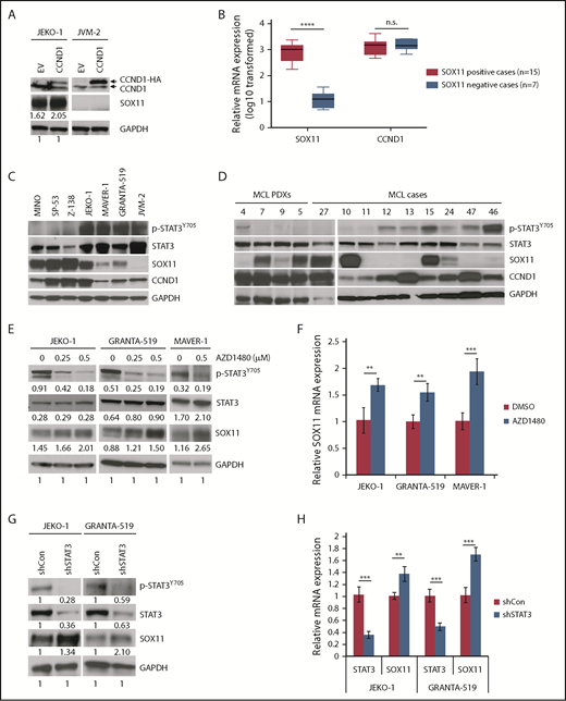 Figure 5. STAT3 negatively regulates SOX11 expression. (A) JEKO-1 and JVM-2 cells were transduced with empty vector (EV) or CCND1-HA, and cell lysates were immunoblotted with indicated antibodies. (B) Box plots of relative SOX11 and CCND1 mRNA expression in primary MCL cases. Gene expression data for SOX11 and CCND1 were obtained from GSE1645534 (supplemental Table 6) and plotted using GraphPad Prism v7.0a. (C-D) Immunoblot analysis of MCL cell lines (C) or MCL PDXs and primary MCL cases (D) with indicated antibodies. (E) Indicated MCL cell lines were treated with indicated doses of the JAK1/2 inhibitor AZD1480 for 16 hours and immunoblotted with indicated antibodies. (F) Indicated MCL cell lines were treated with AZD1480 as in panel E, and SOX11 mRNA was analyzed by qPCR. Shown are the means of mRNA expression levels after normalization to GAPDH signals from 4 independent amplification experiments. (G) JEKO-1 or GRANTA-519 cells were transduced with control or STAT3 shRNA, and protein lysates were prepared for immunoblot analysis with indicated antibodies. (H) Indicated MCL lines were treated with 500 nM of AZD1480 for 16 hours, and SOX11 mRNA was analyzed by qPCR. Bar graphs show the means of mRNA expression levels after normalization to GAPDH signals from 4 independent amplification experiments. Error bars, standard deviation. **P < .01, ***P < .001, ****P < .0001 by 2-sided Student t test. n.s. nonsignificance.