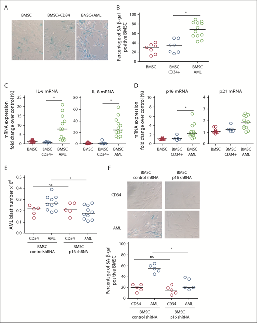 Figure 2. AML-induced senescence in BMSC. (A) BMSC were cultured alone or with primary AML (0.25 × 106; n = 12) or with CD34+ HPC (0.25 × 106; n = 7) for 6 days. Nonadherent cells were removed and BMSC were analyzed for SA-βgal. (B) Bar graph representation of SA-βgal+ cells from panel A. (C) BMSC were cultured alone or with primary AML (0.25 × 106; n = 10) or with CD34+ HPC (0.25 × 106; n = 5) for 6 days. Nonadherent cells were removed and RNA was extracted from the BMSC. RNA was analyzed for IL-6 and IL-8 expression using quantitative reverse transcription PCR. (D) As for panel C, but analyzed for p16 and p21. (E) BMSC were infected with p16 targeted shRNA or control shRNA lentivirus and cultured for 5 days. AML blasts (0.25 × 106; n = 10) or CD34+ HPC (0.25 × 106; n = 5) were cocultured with BMSC with control shRNA or on BMSC with p16 shRNA. AML blast number was assessed using a trypan blue exclusion hemocytometer-based count and CD33/CD45+ staining using flow cytometry. (F) To confirm the senescent profile of BMSC from (E) nonadherent, cells were removed and BMSC were analyzed for senescence associated SA-βgal (n = 5). The Mann-Whitney U test was used to compare between treatment groups (*P < .05). Each dot on the dot plots represents a different AML or CD34 HPC sample. ns, not significant.