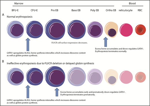 Figure 7. Model describing how heme and GATA1 might coordinately regulate erythroid differentiation. (A) Normal erythropoiesis and (B) erythropoiesis in Flvcr1-deleted mice, patients with DBA, and patients with del(5q) MDS. When erythropoiesis begins, GATA1 upregulates ALAS2 and heme synthesis intensifies. Heme and GATA1 then coregulate erythroid gene expression and differentiation. During normal erythropoiesis (A), heme accumulates late when FLVCR is low. This excessive heme downregulates GATA1 and mitotic spindle proteins to ensure red cell differentiation terminates appropriately. In the absence of FLVCR (B), the quantity of heme exceeds the capacity of globin and other metabolic needs during the CFU-E/proerythroblast stage. This excessive heme then prematurely downregulates GATA1 and mitotic spindle proteins, prematurely terminating differentiation. Effective erythropoiesis requires the quick and efficient upregulation of heme and the facile coordination of heme with globin. In DBA, del(5q) MDS, and potentially other disorders in which protein synthesis is decreased (also B), heme synthesis likewise exceeds the capacity of globin and other hemoproteins in CFU-E/proerythroblasts. This also leads to the premature termination of erythropoiesis, and a clinical phenotype similar to Flvcr1-deleted mice. EB, erythroblast. This figure was illustrated with the Biology PPT Drawing Toolkit (Motifolio Inc).