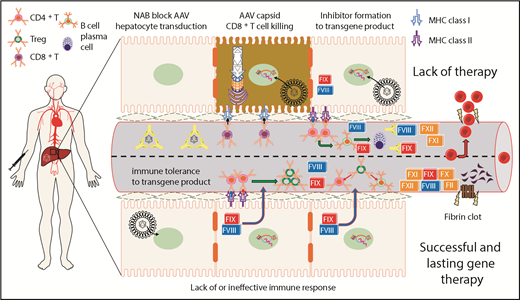 Figure 1. Summary of immunological challenges and successes of liver-directed AAV gene therapy for hemophilia in humans. This is a representation of hepatocytes and LSEC-lined blood vessel within the liver. After intravenous delivery of an AAV vector, viral particles enter the hepatocyte, escape the endosome, and deliver their genetic payload to the nucleus. Preclinical animal models show that FVIII or FIX expression in the liver induces immunological tolerance through conversion of effector CD4+ T cells into Treg. Treg suppress activation of both B- and T-cell responses directed against FVIII or FIX. Preexisting NAB to the AAV capsid can block hepatocyte gene delivery and prevent therapeutic correction of the bleeding diathesis. On successful gene delivery to hepatocytes, primary or recall immune responses may lead to activation of capsid-specific cytotoxic CD8+ T cells and targeted elimination of hepatocytes presenting AAV capsid epitopes on MHC class I. Preclinical animal models of severe hemophilia show that suboptimal gene delivery may fail to induce tolerance to the transgene product because a threshold level of FVIII or FIX expression is needed for successful activation of Treg. In the absence of Treg, effector CD4+ T cells may become activated on recognition of FVIII or FIX epitopes presented on MHC class II, which is primarily expressed on professional antigen presenting cells. The resulting T help promotes B-cell maturation, leading to the production of high-affinity class-switched antibodies and terminal differentiation into antibody secreting plasma cells.