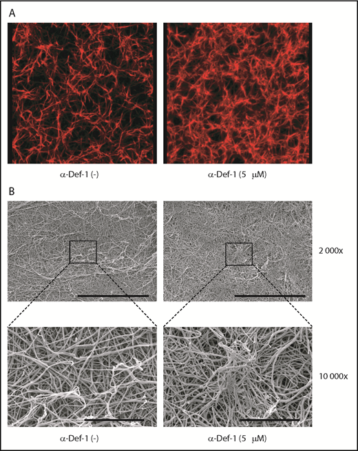 Figure 3. Effects of α-Def-1 on fibrin structure. (A) Representative 3D confocal microscopy images of fibrin clots formed from fibrinogen in the absence (left) or presence (right) of 5 µM α-Def-1. Fibrin was visualized using Alexa Fluor 647–labeled fibrinogen. (B) Representative scanning electron micrographs of fibrin clots formed in the absence (left) or presence (right) of 5 μM α-Def-1 at original magnification ×2000 and ×10 000. Three individual clots were studied at each experimental condition. Scale bars represent 30 μm (top) and 5 μm (bottom).