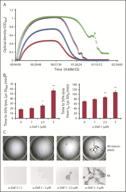 Figure 4. α-Def-1 delays tPA-mediated lysis of fibrin clots. (A) Fibrin was formed as in Figure 2A from fibrinogen supplemented with plasminogen, tPA, and 0-5 µM α-Def-1, and dynamic clot turbidity (A405nm) was measured. The results shown are representative of 4 experiments. (B) The time to attain 50% lysis of the fibrin clots formed in panel A, defined as the time elapsed from the maximal to the half-maximal A405 value (Lys50MA) (left) and the time from initiation of clotting needed to reduce the maximum turbidity of the clot to the half-maximal value (Lys50t0) (right), were determined. The mean ± SD is shown. The results shown are averages from 4 experiments. *P < .05, **P < .01. (C) Photographs of residual fibrin taken after lysis was allowed to proceed for 150 minutes. Images were taken with the EVOS FL Auto Cell Imaging System using EVOS software Scan and Stitch function (top). Individual representative images taken at original magnification ×4 are shown (bottom).