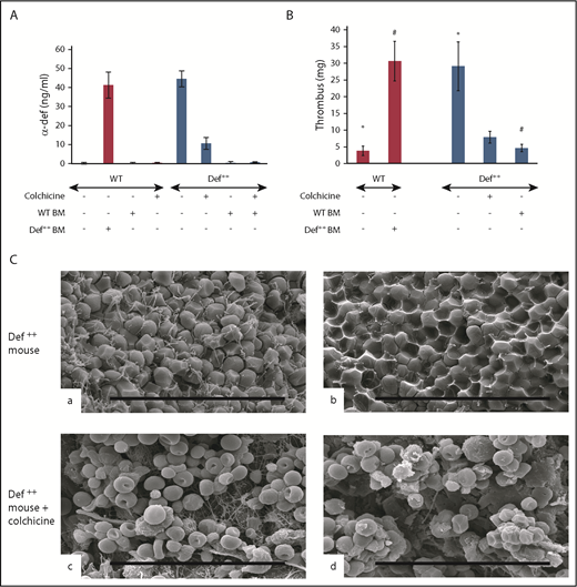 Figure 6. Phenotypic reversion by preventing release of α-defs. (A) Effect of colchicine and BMT on plasma α-defs. Def++ mice were given colchicine or saline in their drinking water for 2 weeks. A second cohort of WT mice underwent BMT from Def++ mice that received either colchicine or saline for 2 weeks. Plasma α-Def-1 was measured by ELISA. Results shown are the mean ± SD in 13 mice. (B) Effect of colchicine and BMT on thrombus development in Def++ mice. IVC stenosis was induced in Def++ mice given colchicine or saline in their drinking water and in Def++ and WT mice after BMT as described in panel A. Thrombus weight was measured as in Figure 4. The mean ± SD in 11 mice is shown (* and #, P < .05). (C) Effect of colchicine on IVC structure in Def++ mice. Scanning electron microscopy images of the surface (a and c) and interiors (b and d) of thrombi extracted from untreated Def++ mice (a and b) and Def++ mice given colchicine (c and d) are shown. Scale bars, 30 μm.