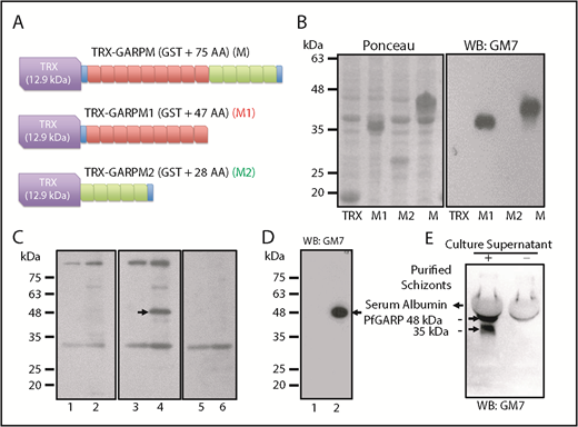 Figure 3. Characterization of GM7 mAb against PfGARP. (A) PfGARP-M was expressed as a fusion protein. TRX tag contributes ∼12.9 kDa, and PfGARP-M consists of 75 AAs. PfGARP-M1 consists of 9 repeats (47 AAs, red), and PfGARP-M2 consists of 5 repeats (28 AAs, green). Blue segments signify the flanking nonrepeat AAs (TPE and VVK) derived from PfGARP-M. (B) Ponceau staining of TRX, PfGARP-M1, PfGARP-M2, and PfGARP-M fusion proteins (left panel). Western blotting results of proteins shown in left panel (right panel). GM7 monoclonal specifically recognized PfGARP-M1 and PfGARP-M but not PfGARP-M2. (C) Detection of PfGARP in infected RBC ghosts. Normal RBC ghosts (lanes 1,3,5) and iRBC ghosts (lanes 2,4,6) were tested by western blotting using preimmune (lanes 1,2) and immunized (lanes 3-4) mouse serum against PfGARP-M. Immune serum detected an ∼48 kDa band (arrow, lane 3) but this band was not detected by preimmune serum (lane 2) in iRBC ghosts. Preincubation of immune serum with excess PfGARP-M prior to western blotting specifically blocked the detection of the 48 kDa band (lane 6). Preimmune serum detected several nonspecific bands. (D) Detection of 48-kDa PfGARP in iRBC ghosts. Normal RBC ghosts (lane 1) and iRBC ghosts (lane 2) were evaluated by western blotting using purified GM7 monoclonal. A single ∼48-kDa band was detected (lane 2, arrow). In fact, all hybridoma clones recognized the same band. Hybridoma clone #7 was selected and designated as GM7 for all subsequent studies. (E) Detection of native PfGARP in the P falciparum 3D7 culture supernatant of magnetically purified schizonts. Western blotting using GM7 detected 2 bands at ∼48 kDa and ∼38 kDa (arrows). The 38-kDa band represents a secondary processed secretory form of PfGARP or a degradation product of 48-kDa polypeptide detected in iRBC ghosts.