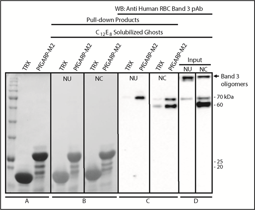 Figure 6. Identification of RBC band 3 binding to PfGARP using pull-down assay. TRX–PfGARP-M2 was used to pull down potential binding proteins from detergent-solubilized RBC ghosts. (A) Coomassie blue–stained 12% gel (sodium dodecyl sulfate–polyacrylamide gel electrophoresis) showing TRX and TRX–PfGARP-M2 attached to cobalt beads. (B-C) TRX and TRX–PfGARP-M2 attached to beads were incubated with C12E8 solubilized normal untreated (NU) and chymotrypsin-treated (NC) ghosts. Bound proteins were transferred to nitrocellulose membrane. (Ponceau S staining). (C) Anti-band 3 western blotting. The 70-kDa band specifically associated with TRX–PfGARP-M2 in untreated RBCs (left panel). The 60-kDa and 70-kDa bands were detected in the chymotrypsin-treated RBCs (right panel). No binding of band 3 was detected with TRX-bound beads. (D) Western blot of C12E8-solubilized normal and chymotrypsin-treated ghosts as inputs. Western blotting of TRX–PfGARP-M2 and TRX proteins alone did not show any nonspecific signal detected by anti-band 3 antibody (data not shown).