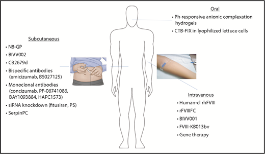 Figure 2. Expanded modes of administration with novel therapeutics for hemophilia. Hemophilia therapeutics have traditionally been limited to IV delivery, but new technologies have expanded to allow additional modes of administration. Subcutaneous injection of bioengineered clotting factors (N8-GP, BIVV002, CB2679d), as well as novel nonfactor therapeutics, may reduce the treatment burden, particularly in those patients with difficult IV access. Oral administration (CTB-FIX and pH-responsive anionic complexation hydrogels) would provide a noninvasive option, improving ease of administration, as well as patient compliance.