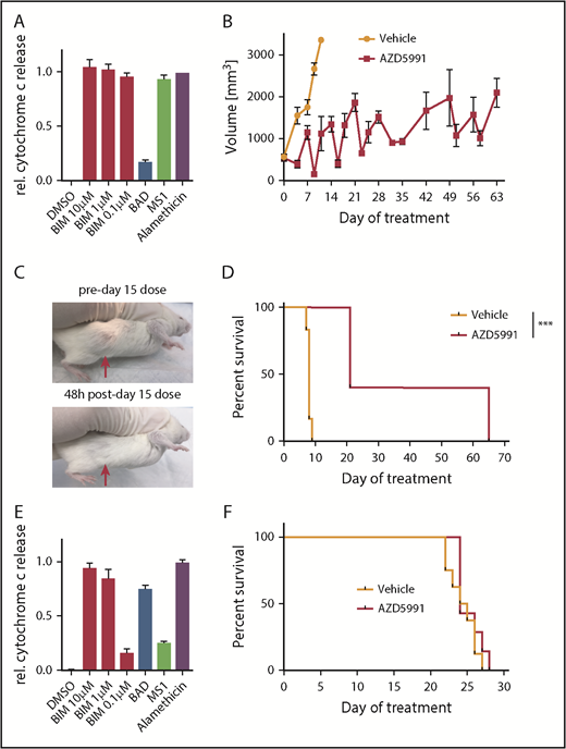 Figure 3. Activity of AZD5991 and AZD5991+CHOP in vivo. (A) BH3 profile of WCTL-91953. (B) Tumor volume of mice treated with vehicle or AZD5991 once weekly (d1), n = 6 per arm. (C) Representative example of a subcutaneous tumor of WCTL-91953 before and after the third dose of AZD5991. (D) Survival curve of mice engrafted with WCTL-91953 and treated with either vehicle or AZD5991. (E) BH3 profile of the T-PLL PDX DFTL-28776. (F) Survival of mice engrafted with DFTL-28776 and treated with either vehicle or AZD5991 once weekly (d1), n = 6 per arm. DMSO, dimethyl sulfoxide.