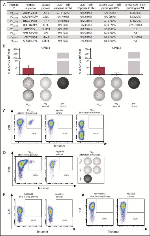 Figure 5. Immunogenicity of HLA class I–restricted CML-associated antigens. (A) Immunogenicity analysis results for the 8 HLA class I–restricted CML-associated peptides with their respective frequencies of preexisting immune recognition by PBMCs from CML patients or HVs in IFN-γ ELISPOT assays (CD8+ T-cell response in CML/HVs), as well as the frequencies of peptide-specific CD8+ T cells detected after in vitro aAPC-based priming experiments with naive CD8+ T cells from HVs and CML patients. (B) Examples of CML-associated ligands evaluated in IFN-γ ELISPOT assays after a 12-day stimulation using PBMCs from CML patients. Results are shown for immunoreactive peptides only. Phytohemagglutinin was used as positive control and the HLA-A*02–restricted DDX5_HUMAN148-156 peptide YLLPAIVHI served as negative control. Data are expressed as mean ± standard deviation of 2 independent replicates. Naive CD8+ T cells from HVs (C) and CML patients (D) were primed in vitro using aAPCs. Graphs show single viable cells stained for CD8 and PE-conjugated multimers of indicated specificity. Tetramer staining was performed after 4 stimulation cycles with peptide-loaded aAPCs. The left panels show P3A*03-tetramer (C) or P7B*07-tetramer (D) staining. The middle panels (negative control) depict P3A*03-tetramer (C) or P7B*07-tetramer (D) staining of respective T cells primed with an irrelevant peptide. The right panels show T cells from the same donor that were tested for the absence of preexisting memory T cells after a 12-day recall stimulation by tetramer staining (C) or IFN-γ ELISPOT assay (D). (E) Tetramer staining after 4 stimulation cycles with negative control peptide-loaded aAPCs (HLA-A*02, YLLPAIVHI, DDX5_HUMAN148-156 and HLA-A*03, QIFVKTLTGK, UBC_HUMAN2-11). ID, identification; neg., negative; n.t., not tested; pos., positive; SFU, spot-forming unit; UPN, uniform patient number.