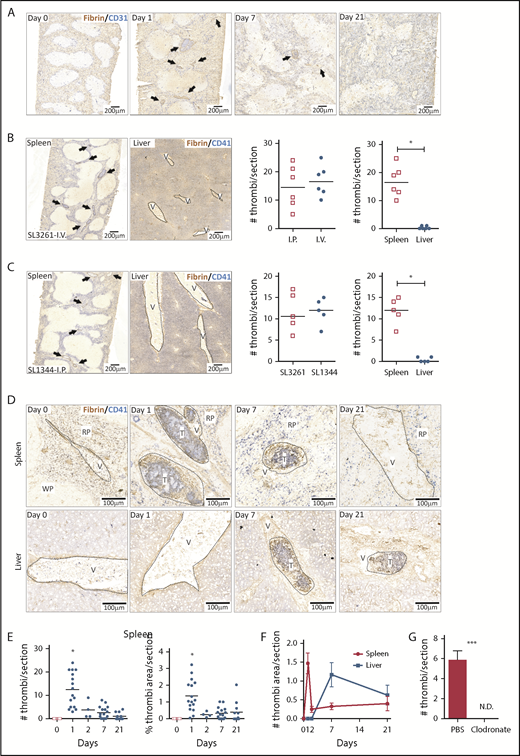 Figure 1. Thrombosis in the spleen and liver follows different kinetics after STm infection. (A) Frozen spleens from WT mice infected with 5 × 105 STm intraperitoneally (IP) were sectioned longitudinally to the hilum (≥1200 μm deep), and 5-μm sections were stained by IHC. Scans of stained spleen sections from mice infected for 0, 1, 7, and 21 days show blood vessels identified with anti-CD31 in blue and thrombi with antifibrin/fibrinogen in brown. Arrows identify individual thrombi. (B) Representative low power images of spleen and liver sections stained for CD41 (platelets; blue) and fibrin/fibrinogen (brown) from mice infected for 24 hours via the IV route with 5 × 105 STm SL3261. Arrows identify individual thrombi. The left-hand graph shows the number of thrombi per spleen section for mice infected IP or IV. The right-hand graph shows the number of thrombi per section in the spleen and liver from these IV-infected mice. (C) Representative low-power images of spleen and liver sections stained for CD41 (platelets; blue) and fibrin/fibrinogen (brown) from mice infected for 24 hours with the 105 virulent STm SL1344 strain. Arrows identify individual thrombi. The left-hand graph shows the number of thrombi per spleen section for mice infected with SL3261 (attenuated) or SL1344 (virulent). The right-hand graph shows the number of thrombi per section in the spleen and liver from mice infected with SL1344. (D) Representative scans at higher magnification of spleen sections (top) and liver sections (bottom) from WT mice at days 0, 1, 7, and 21 after infection with 5 × 105 STm SL3261. Sections are stained for fibrin/fibrinogen (brown) and CD41 (blue). RP, red pulp; T, thrombus; V, vein; WP, white pulp. (E) Quantification of numbers of thrombi per spleen section (left graph) and the proportion of section area covered by thrombi (right graph) at days 0, 1, 2, 7, and 21 after infection with 5 × 105 STm SL3261. Each point represents a single mouse (data are combined from 3 independent experiments); *P < .05 by 1-way ANOVA. (F) Line graph showing the level of thrombosis in the spleen (red line) and the liver (blue line) over the first 3 weeks of infection with 5 × 105 STm SL3261. The data are expressed as mean ± standard error of the mean from at least 4 mice per group combined from 3 independent experiments. (G) Quantification of thrombi in spleen sections from phosphate-buffered saline (PBS) liposomes or clodronate-liposome–pretreated mice infected for 24 hours with 5 × 105 STm SL3261. Combined data from 2 experiments with a total of 8 mice in each group are shown; *P < .05, ***P < .001 by 2-tailed nonparametric t test. N.D., not detected.