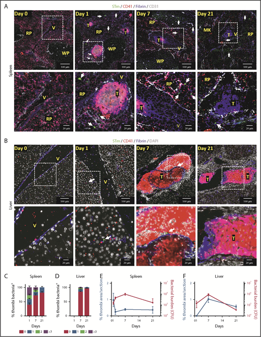 Figure 2. Detection of bacteria within thrombi. (A-B) Representative immunofluorescence photomicrographs of spleens (A) and livers (B) from WT mice infected with 5 × 105 STm SL3261 for 0, 1, 7 and 21 days. MK, megakaryocyte; RP, red pulp; T, thrombus; V, vein; WP, white pulp. Fibrin, blue; CD31, white; CD41, red; STm, green (indicated with white arrows). For panels A and B, the second row shows a higher-magnification image of the area identified by the white box. (C-D) Frequency of detecting 0, 1, 2, or ≥3 bacteria in thrombi in sections from spleens and livers, respectively, from mice infected with 5 × 105 STm SL3261 for 0, 1, 7, or 21 days. (E-F) Line graphs showing the kinetics of thrombosis (blue) and bacterial colonization (red) in spleens and livers respectively, from mice infected with 5 × 105 STm SL3261 for 0, 1, 2, 7 or 21 days. Data are expressed as mean ± standard error of the mean from 152 thrombi counted in spleens from day 1–infected mice, 40 from day 7–infected mice, and 18 from day 21–infected mice. In liver, 411 thrombi were counted for days 7 and 23 for day 21 postinfection. In each case, thrombi were counted from at least 4 mice per group and are combined from 3 independent experiments. CFU, colony-forming unit.
