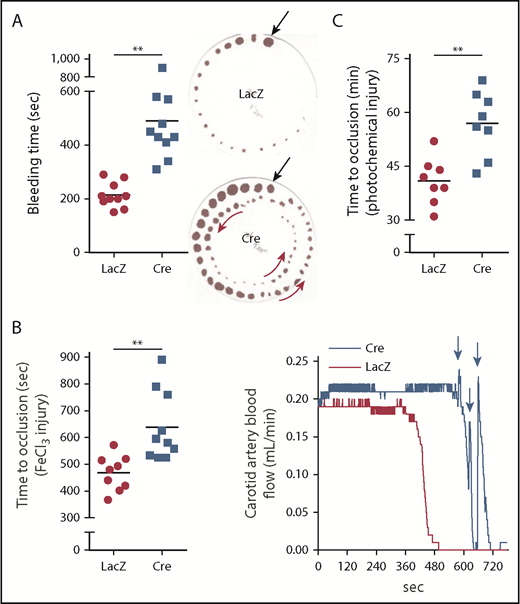 Figure 2. DACH1 deletion in hepatocytes increases bleeding time and time to thrombotic carotid occlusion in mice. (A) Tail bleeding time and representative images of bleeding patterns on filter paper. Black arrows indicate beginning bleeding time course, and red arrows depict episodes of rebleeding. Time to occlusive carotid arterial thrombosis induced by 10% FeCl3 injury (B) or Rose bengal/laser photochemical injury (C). (B) Representative blood flow pattern. The red arrows depict rapid increases in blood flow after transient occlusions, suggestive of transient recanalization of the clotted vessel. **P < .01, 2-tailed Student t test (n = 8-10 mice per group).