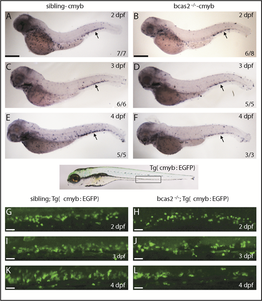 Figure 3. The number of HSPCs was reduced in the CHT of bcas2−/− zebrafish. (A-F) The WISH assay of definitive HSPCs using a cmyb probe from 2 to 4 dpf indicates that the number of HSPCs was decreased in the CHT of bcas2−/− mutants from 3 dpf compared with siblings. Scale bars, 200 μm. (G-L) Live imaging showed that EGFP-positive HSPCs in bcas2−/−/Tg (cmyb: EGFP) zebrafish begin to decrease noticeably in the CHT region from 3 to 4 dpf compared with siblings/Tg (cmyb: EGFP). Scale bars, 50 μm.