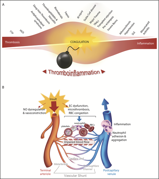 Figure 1. Thromboinflammation: an important pathogenic process linked to a diverse range of human diseases. (A) A broad spectrum of human disorders is associated with thromboinflammatory complications, many of which have microvascular dysfunction. It is likely that the level of α-thrombin generation is a key determinant of the extent of the thromboinflammatory response. For example, diseases such as sepsis, ischemia reperfusion (IR) injury (the focus of this review), and organ transplant rejection are associated with widespread activation of coagulation throughout the microcirculation, which is accompanied by an intense thrombotic and inflammatory response. At the extremes of this spectrum, the microvascular thrombotic disorder thrombotic thrombocytopenia purpura (TTP) exhibits limited α-thrombin generation and is associated with a limited inflammatory response in the early phase of the disease. At the other end of the spectrum, autoimmune diseases, such as rheumatoid arthritis and systemic lupus erythematosus (SLE), are primarily considered inflammatory disorders, with a limited role for α-thrombin. Nonetheless, other hemostatic components appear to contribute to the pathogenesis of these diseases. (B) Tissue or organ injury by diverse pathogenic mechanisms is commonly associated with microvascular thromboinflammatory responses. Microvascular obstruction can be mediated by all cellular elements in blood, including platelets, neutrophils, and red blood cells (RBCs), with stable occlusion typically linked to the activation of coagulation and fibrin generation. Regardless of the primary insult to tissues or organs (infection, ischemia, or trauma), the ultimate outcome of these disorders is heavily influenced by the extent of the microvascular thrombotic and inflammatory responses. EC, endothelial cell; HUS, hemolytic-uremic syndrome; NO, nitric oxide; TRALI, transfusion-related acute lung injury.
