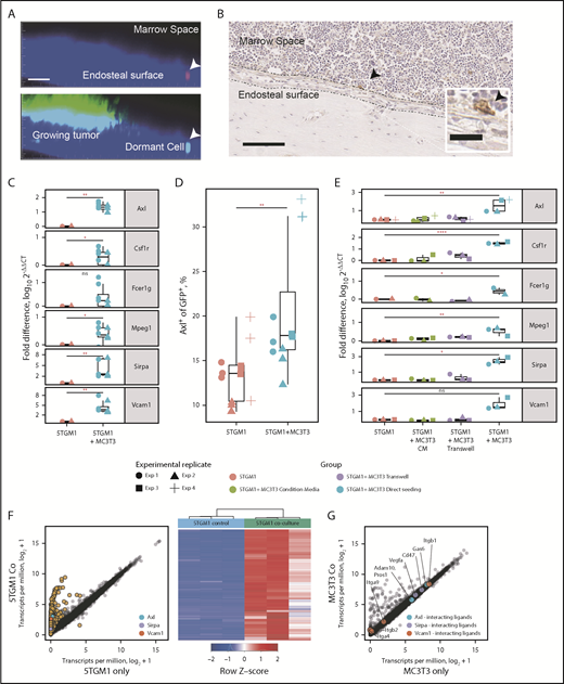 Figure 5. Niche-dependent induction of the myeloid gene signature. (A) Intravital imaging of a dormant MM cell (arrow) residing on the endosteal surface and a growing MM colony. Top shows the DiD (red) channel, and bottom shows the eGFP (green) channel. Scale bar = 50 µm. (B) Immunohistochemical staining for CD138 showing an individual 5TGM1 tumor cell (arrow) adjacent to the endosteal bone surface. Scale bar = 50 µm; inset scale bar = 20 µm. (C) Real-time quantitative polymerase chain reaction (RT-qPCR) of myeloid marker genes from 5TGM1 cells cultured with and without MC3T3 cells. (D) Flow cytometric analysis of AXL expression by 5TGM1 cells cultured with and without MC3T3 cells. Symbols denote different experimental replicates. (E) RT-qPCR of myeloid marker genes from 5TGM1 cells cultured alone, with MC3T3 conditioned media (CM), and with MC3T3 cells seeded directly or separated by a transwell. (F) Scatter plot of genes expressed by 5TGM1 cells cultured alone or with MC3T3 cells (left); heatmap of differentially expressed genes (right). (G) Scatter plot of genes expressed by MC3T3 cells cultured alone or with 5TGM1 cells. (C-E) Each point represents an independent experiment. Horizontal lines are the median; box indicates the IQR. Mann-Whitney test: *P < .05, **P < .01, ****P < .0001. ns, not significant.