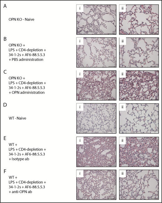Figure 4. Lung tissue histology of OPN-related TRALI responses. (A-F) Histology performed on lung tissue from the indicated mouse groups. (i-ii) H&E-stained lung tissue images taken at original magnification (i) ×20 and (ii) ×40. Representative images of each indicated group are shown. Scale bars, (i) 100 µm and (ii) 50 µm. ab, antibody.