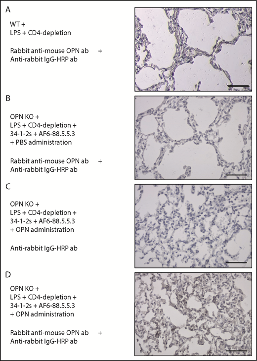 Figure 5. OPN is present in murine TRALI lungs. (A-D) Detection of OPN in the lungs using immunohistochemistry in the indicated mouse groups. Panels on the right represent lung tissue images taken at original magnification ×40 with specific antibody stain after the indicated immunohistochemistry treatments. Scale bars, 50 µm.