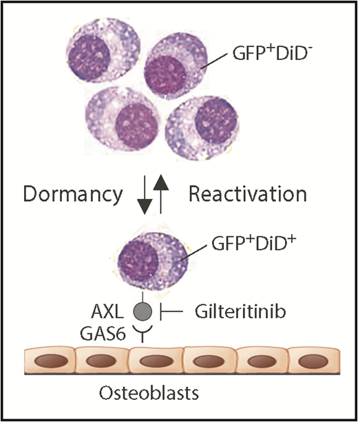 Schematic depiction of myeloma dormancy as a reversible, dynamic state induced, in part, by binding of GAS6 on osteoblasts to the receptor tyrosine kinase, AXL, on mouse 5TGM1 myeloma cells. In this experimental model system of human myeloma, the reactivation of a miniscule fraction of dormant tumor cells suffices to generate bulk myeloma in the hematopoietic bone marrow (eg, as few as ∼15 cells account for the total tumor burden in long bones of untreated mice).5 New findings reported implicate the endosteal niche in a novel, environmentally induced phenotypic change in dormant myeloma cells that includes the ectopic expression of myeloid genes, such as Axl and Vcam1 (which partners with α4β1 integrin on osteoblasts; not shown). Additionally, Khoo et al demonstrate that dormant myeloma cells can be dislodged from survival-protecting niches using small-compound AXL inhibitors. Gilteritinib, an AXL-inhibiting drug that very recently won US Food and Drug Administration approval for the treatment of adult patients with acute myeloid leukemia that harbors mutated FLT3, may lend itself to evaluating this possibility in clinical trials of myeloma. In addition to promoting dormant myeloma cells, the interaction of AXL and GAS6 in the osteoblastic niche also governs dormancy of prostate cancer cells9 and survival and self-renewal of chronic myeloid leukemia stem cells.10 GAS6, growth arrest specific 6.