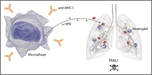 OPN mediates TRALI via stimulation of pulmonary neutrophil accumulation. The infusion of anti-MHC I antibodies triggers TRALI. OPN is released by macrophages, potentially as a result of the presence of anti-MHC I, and in its polymerized form, it accumulates in lungs. OPN in the lungs acts as a potent neutrophil chemoattractant. The efflux of neutrophils in lungs mediates TRALI.