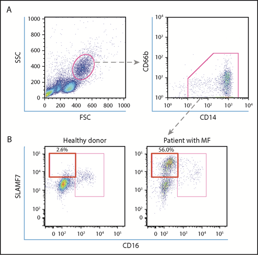 Figure 1. Analysis of SLAMF7high CD16− monocytes in the PB of HCs and MPN patients with MF. (A) To define SLAMF7highCD16− monocytes, we began by gating lymphocyte subsets in a forward scatter/side scatter dot plot. Subsequently, we gated CD14+CD66b− monocytes and divided them into SLAMF7highCD16−, SLAMF7lowCD16−, and CD16+ subsets. (B) The representative flow cytometry dot plot shows that the percentage of SLAMF7highCD16− monocytes increased in MPN patients with MF who harbored JAK2V617F compared with HCs. The ratios of the SLAMF7highCD16− subset to CD14+CD66b− monocytes are presented as percentages.