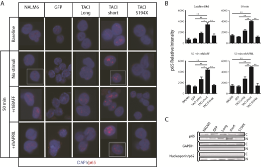 Figure 6. Differential NF-κB activation by TACI isoforms in human pre-B cells. (A) Confocal microscopy of isolated nuclei from NALM6 nontransduced cells, NALM6 GFP, NALM6 with TACI short or long isoforms, and nonsignaling TACI S194X mutant cells, cultured as in Figure 4 and stained for p65 (red); nuclei were counterstained with DAPI (blue). Images show white dividing lines for cells taken from the same field. Original magnification ×63. (B) Quantitative assessment of p65 nuclear translocation (relative to cell number), represented as p65 relative intensity. The mean percentage and standard error were calculated from 3 independent experiments; error bars represent standard error of the mean. *P < .05; **P < .01; 2-tailed unpaired Student t test. (C) Immunoblot analysis of p65 nuclear translocation after subcellular fractionation of resting cells after 6-hour starvation. (C: cytoplasmic fraction; N: nuclear fraction; GAPDH: cytoplasmic fraction loading and purification control; and Nucleoporin/p62: nuclear fraction loading and purification control). For quantitation of nuclear p65 levels, >200 cells were microscopically assessed and analyzed with ImageJ software.