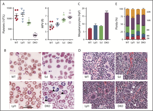Figure 2. Phenotype of single-KO and DKO mice. (A) Platelet count and volume for mice of each genotype with mean ± SEM shown. Results analyzed using two-way ANOVA with Tukey’s correction. *P < .01 and **P < .001 compared with WT mice. (B) Representative peripheral blood smear for each genotype showing enlarged platelets (arrowheads) in DKO mice. May-Grünwald-Giemsa stain. (C) Mean ± SEM number of bone marrow megakaryocytes (n = 3 per genotype). Results analyzed using two-way ANOVA with Tukey’s correction. ***P < .0001 compared with WT mice. (D) Representative bone marrow sections with abnormal megakaryocytes (arrowheads arrows) in DKO mice. Hematoxylin-eosin stain. (E) Mean ± SEM for ploidy of freshly isolated megakaryocytes (n = 3 per genotype). fl, femtoliter; hpf, high-power field; MPV, mean platelet volume.