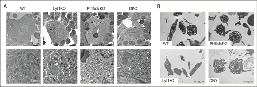 Figure 4. Transmission electron microscopy. (A) Representative images of megakaryocytes for each genotype. Arrows indicate emperipolesis (Pf4Sclc-KO) and prominent mitochondria (DKO). Upper panels (original magnification ×1000). Lower panels (original magnification ×8000). (B) Representative images of platelets for each genotype.