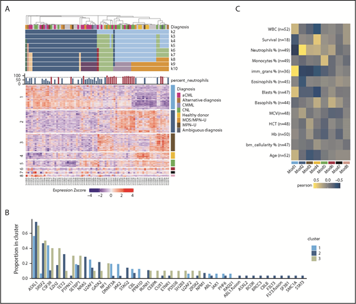 Figure 6. Differential gene expression may guide clinical diagnosis. (A) Consensus clustering heatmap of expression values (Z score; mean centered and divided by standard deviation) (k = 2 through k = 10). Rows are first split by their WGCNA module membership and then clustered by expression values. The module number is on the left, and the corresponding color is on the right. Heatmap columns were clustered by consensus clustering (k = 7). (B) The barplot demonstrates the gene mutation frequencies colored by the consensus clustering result. (C) Heatmap summary of Pearson correlations of the WGCNA module eigengenes and the numeric clinical variables. The y-axis indicates the clinical variables with the number of samples used in the correlation shown as n. The x-axis indicates the module name/color. Note that the survival data are only limited to samples with noncensored data. HCT, hematocrit; MCV, mean corpuscular volume.