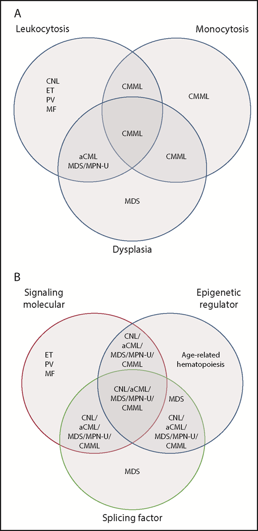 Distribution of myeloid neoplasms discussed in Zheng et al based on the current classification vs genetic pathway alterations revealed in the study. (A) Venn diagram of current (2016) WHO classification reflecting associations with leukocytosis, dysplasia, or monocytosis. Currently, monocytosis supersedes other features in determining a diagnosis of CMML, whereas granulocytic dysplasia (with left-shift) is the main feature distinguishing atypical CML (aCML), BCR-ABL1 negative from CNL. (B) A proposed Venn diagram showing the association of these disease subtypes with pathway mutations. There is significant overlap between entities that are considered distinct in the WHO classification, yet CNL and the MDS/MPN diseases remain largely separate from MDS and from the other “pure” MPN: essential thrombocythemia (ET), polycythemia vera (PV), and primary myelofibrosis (MF). MDS/MPN-U, MDS/MPN, unclassifiable. Panel B has been adapted from Figure 2D in the article by Zhang et al that begins on page 867.