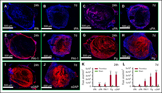 Expression of fibrinolytic system components in 24 h and 7 days old venous thrombi. Panels A-F show the expression (red) of (A-B) tPA, (C-D) uPA, (E-F) PAI-1, (G-H) plasminogen (Pg), (I-J) α2AP, and (K-L) their quantification in 8-µm cryosections of 24 hours and 7 days thrombi as labeled. Red color (Alexa Fluor 555) represents each component as labeled and blue color shows 4′,6-diamidino-2-phenylindole–stained nuclei. For comparison, IVC from sham mice were immunostained and quantified for each antibody under the same color range in the histogram mode of Image Pro-Plus software. The total immunostained area (arbitrary units; AU/mm2) for each protein was measured in 500 μm (original magnification ×4) images of an IVC sample. (N = 4-5 per group, mean ± SEM). *P < .05, **P < .01, ***P < .001.