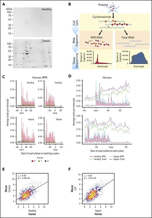 Translational events in platelets are increased coordinately in clinical and experimental sepsis. (A) Isolated platelets from septic patients or matched, healthy donors were incubated with 35S-methionine (t = 18 hours) to label newly synthesized proteins and then analyzed by 2D gel electrophoresis. Representative 35S-methionine–labeled 2D gel of platelets from a septic patient and healthy donor (representative of n = 3/group). (B) Schematic of protocol for sequencing total RNA (RNA-seq) and ribosome protected mRNA reads (RPRs, ribosome footprint profiling) in isolated human and murine platelets. (C) Ribosome footprint profiling of platelets from healthy donors and septic patients (n = 3/group) demonstrating global triplet periodicity. Increased reads align with frame 0 (red) compared with frame 1 (green) and frame 2 (blue). Frame number indicates distance from the first nucleotide of the P site. (D) Depiction of global number of reads per transcript for total RNA (healthy, green; sepsis, purple) and RPR (healthy, red; sepsis, blue) relative to the start and stop codon. (E) Correlation plot of the expression of orthologous, conserved RPRs in platelets from untreated control mice (n = 4) and healthy human donors (n = 3). (F) Correlation plot of the expression of orthologous, conserved RPRs in platelets from CLP-treated mice (n = 3, pooled platelets) and septic patients (n = 3).