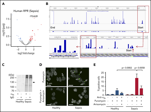 De novo translation of αIIb protein is increased in human platelets during clinical sepsis. Platelets were isolated from septic patients or matched healthy donors. (A) Volcano plot showing significantly, differentially expressed (FDR <0.05) ribosomal protected mRNA reads (RPRs) in platelets from septic patients or healthy donors (n = 5/group). ITGA2B is labeled. (B) Magnification of IGV file demonstrating triplet periodicity for ITGA2B. Here, ribosomes read the mRNA in groups of 3 nucleotides (a triplet) at a time where each triplet codon represents an amino acid code. mRNAs undergoing active translation will have ribosome reads generally stacked on the first nucleotide of each codon across the mRNA. This is termed triplet periodicity. (C) Newly synthesized αIIb protein (arrow) in platelets from septic patients detected by radiolabel (35S-methionine) and immunoprecipitation using an anti-αIIb antibody. An immunoglobulin G isotype-matched antibody was used as a control (representative of n = 3/group). (D) Confocal microscopy image of Duolink proximity ligation assay with puromycin demonstrating de novo translation of αIIb protein (green, arrows) in platelets from septic patients and healthy donors (n = 3/group). Anisomycin inhibits protein synthesis and was used here to demonstrate specificity of this system (eg, reduced staining for αIIb in the presence of anisomycin). (E) Quantification of percent positive cells for αIIb protein by CellProfiler, as described in “Methods.”