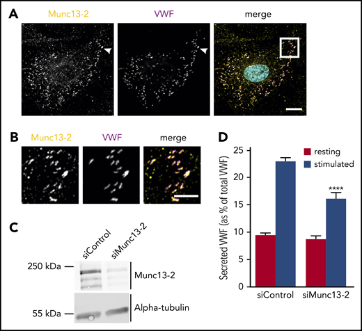 Munc13-2 localizes to WPB and positively regulates histamine-induced secretion of VWF. (A) HUVEC were fixed and stained for Munc13-2 (yellow) and VWF (magenta) using specific antibodies. Nuclei are shown in cyan. Scale bar, 10 µm. (B) Higher magnification of the boxed region in panel A (merge). Note that almost all VWF-containing WPB are also positive for Munc13-2. As Rab3b and Rab27a are markers for more mature WPB, this could suggest that Munc13-2 might be recruited to WPB in a Rab3b/27a-independent manner. Scale bar, 5 µm. (C-D) Munc13-2 was depleted by transfection with specific siRNAs (siMunc13-2), nontargeting siRNA served as control (siControl). Knockdown efficiency was confirmed by western blot analysis using anti-Munc13-2 antibodies and anti-α-tubulin antibodies as loading control (C). The effect of Munc13-2 depletion on histamine-induced secretion of VWF was measured by an enzyme-linked immunosorbent assay quantifying the amount of VWF released into the cell culture supernatant (D). Note the significant reduction of histamine-evoked VWF secretion after Munc13-2 knockdown. n = 3. Error bars + standard error of the mean. ****P ≤ .0001.